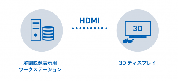 スタンドアロン型パッケージ